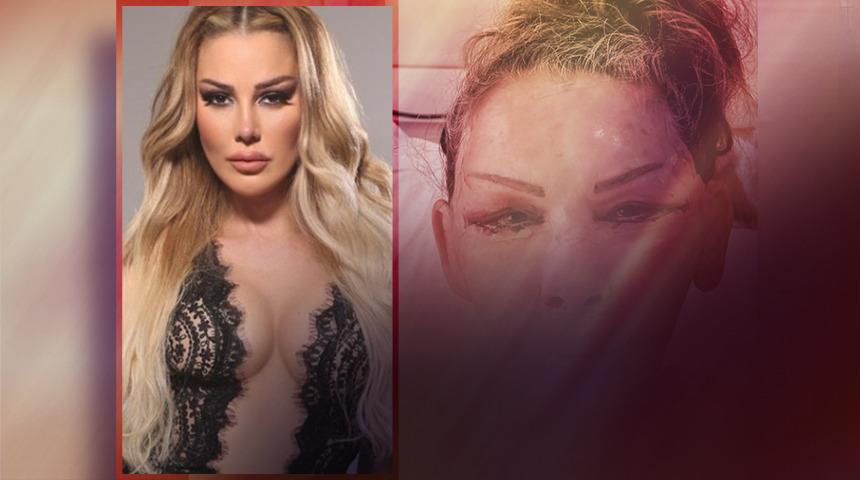 Petek Dinçöz'ün annesi yüz gençleştirme ameliyatı olmuştu! Esra Süay Toğuş'un son halini doktoru paylaştı! Görenler şaştı kaldı