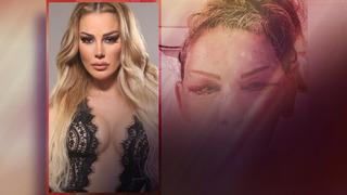 Petek Dinçöz'ün annesi yüz gençleştirme ameliyatı olmuştu! Esra Süay Toğuş'un son halini doktoru paylaştı! Görenler şaştı kaldı