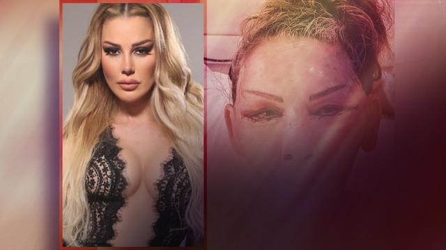 Petek Dinçöz'ün annesi yüz gençleştirme ameliyatı olmuştu! Esra Süay Toğuş'un son halini doktoru paylaştı! Görenler şaştı kaldı
