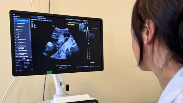 Yüksek riskli gebelikler dikkat! Perinatoloji uzmanı takibi önemli...