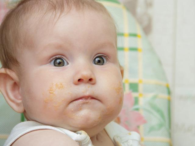 Bebeklerde besin alerjisine dikkat! Ciddi reaksiyonlara neden olabilir: "Ailenin uyarılması gerekir” 