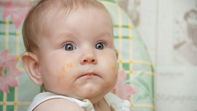 Bebeklerde besin alerjisine dikkat! Ciddi reaksiyonlara neden olabilir: Ailenin uyarılması gerekir” 