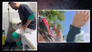 Kuralsız Sokaklar’ın sunucusu Youtuber Mert Öztürk motor kazası yaptı! Ucuz yırttım diyerek o anları paylaştı