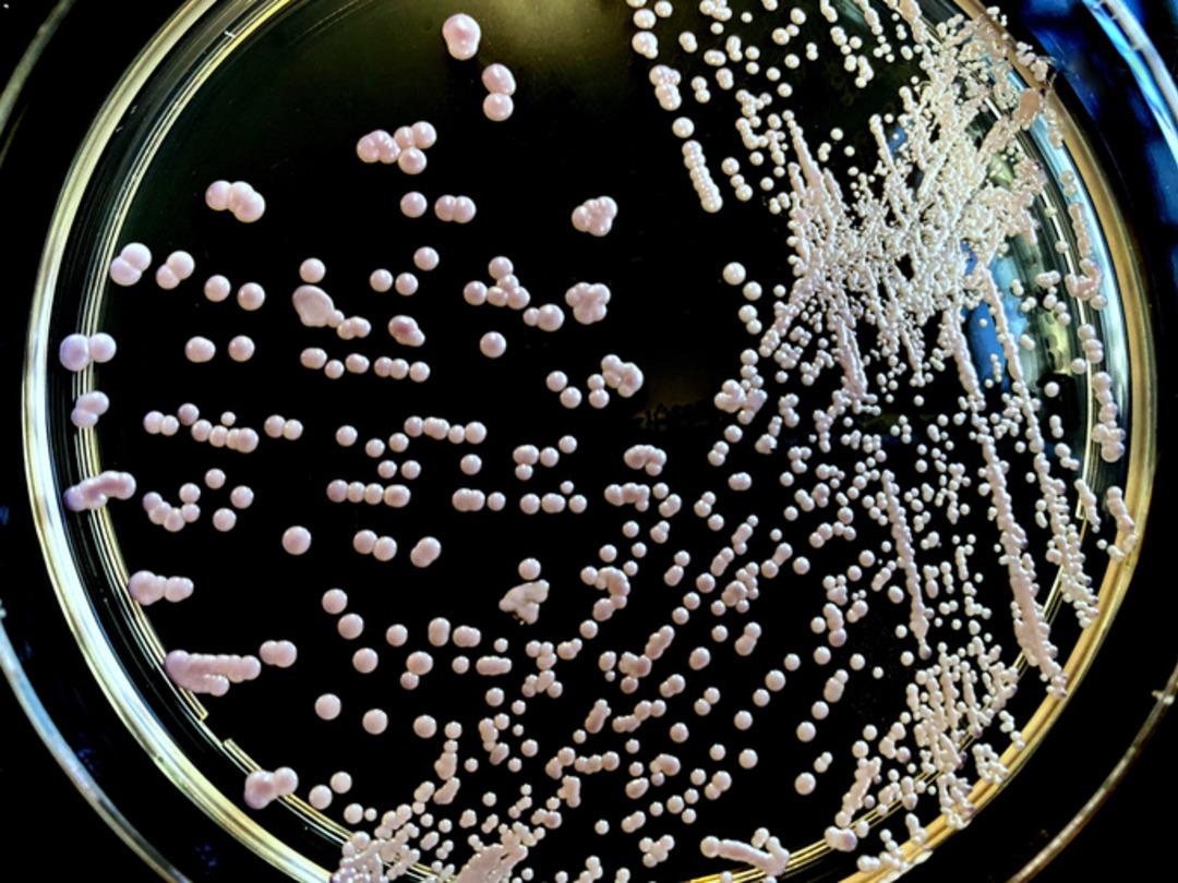 Superbug-Krise! Weltweite Alarmglocke: Wirtschaft und Gesundheit bedroht! Todesfälle könnten um 60 % steigen! Sind Superbugs eine stille Bedrohung? Experten: