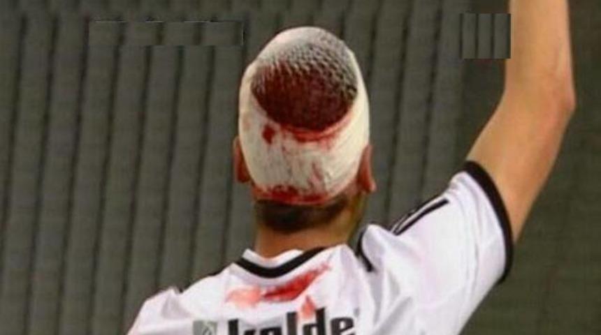 Mustafa Pektemek'in b&uuml;y&uuml;k şanssızlığı!