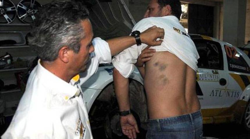 Ralli pilotları darp edildi