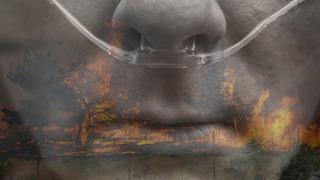 Orman yangınlarının görünmeyen tehlikesi! Akciğerleri hasta edebilir: Özellikle bu hastalıkları olanlar dikkat! Uzmanlar uyarıyor...