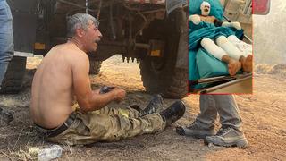 Yanıyorum diye feryat etmişti! Orman yangınında ağır yaralanan işçinin son hali ortaya çıktı