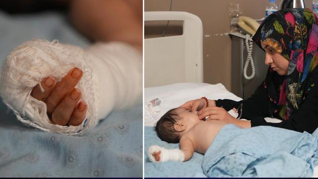 Hastanede skandal: Makasla 3 aylık bebeğin parmağını kesti!