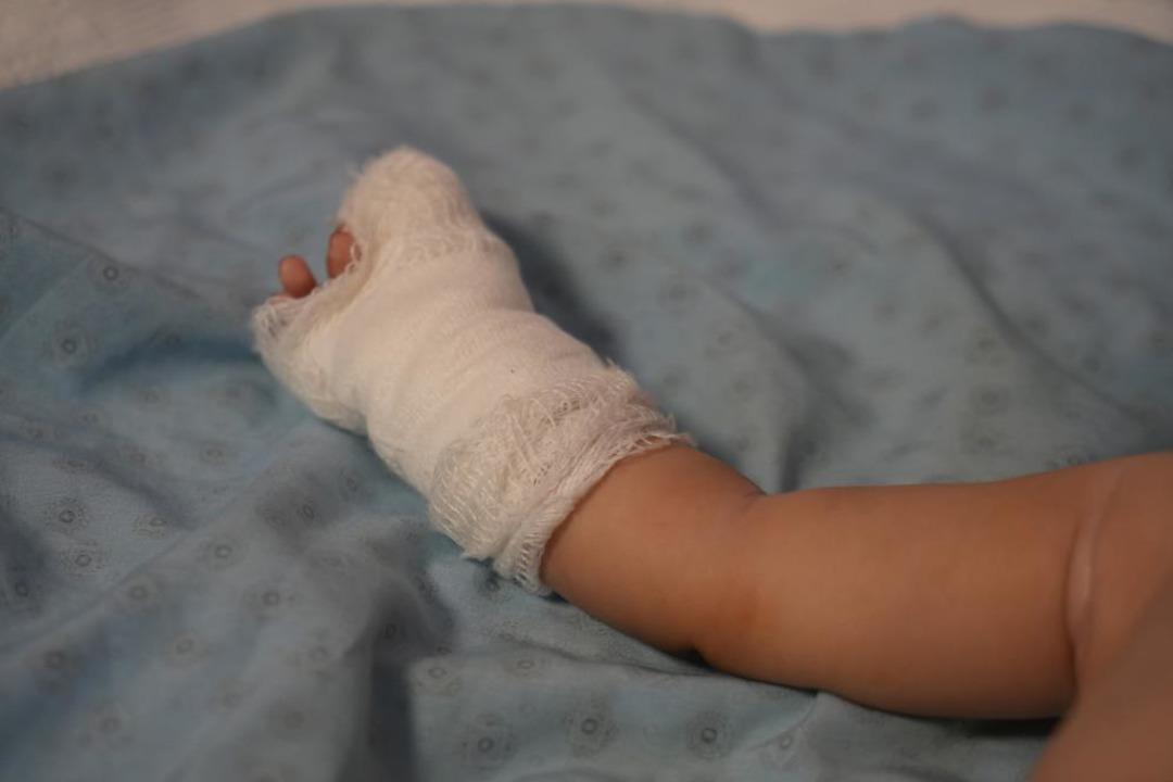 Hastanede skandal: Makasla 3 aylık bebeğin parmağını kesti! 5