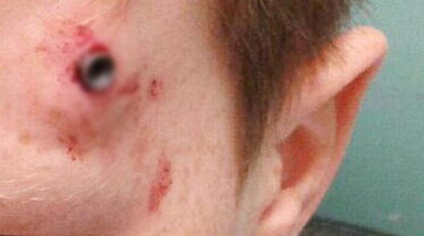 Oyuna girerken, başından vuruldu