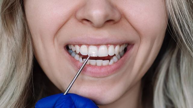 Sağlık Bakanlığı 2025 verileri: Menopoz yaşı düşüyor, risk erken başlıyor 40’lı yaşlarda diş kaybının nedeni erken menopoz olabilir! Östrojen azalınca dişler zarar mı görüyor?