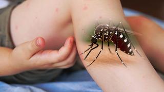 Küresel salgın uyarısı! DSÖ tüm ülkeleri uyarıyor: Sivrisinekler yolu ile bulaşan 'chikungunya' virüsü tehlikesi! Türkiye'de 'chikungunya' virüsü görülüyor mu?