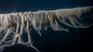 Serinletmesi gerekirken yakıyor... Akdeniz kıyılarımızda yüzen mikroplar: Denize giren kaçarak geri çıkıyor!