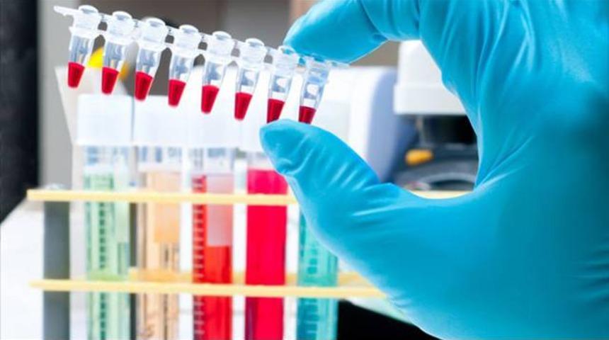 Halter milli takımına doping baskını