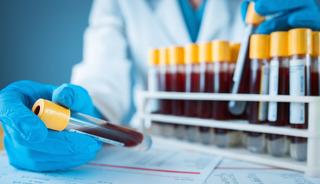 Bilim d&uuml;nyası şaşkın! Kan testinde iki cinsiyet ortaya &ccedil;ıktı