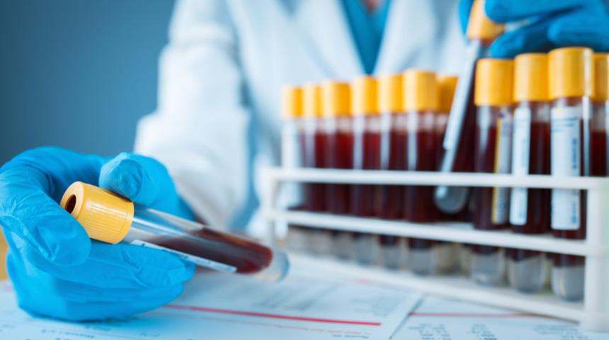 Bilim d&uuml;nyası şaşkın! Kan testinde iki cinsiyet ortaya &ccedil;ıktı