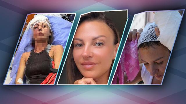 Ukraynalı Iryna Antalya'da dehşeti yaşadı! Sokakta sopayla darp iddiası! Şu an içeride ama hala korkuyorum