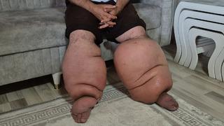 15 yıl önce hayatı geri dönülmez şekilde değişti: Yüksek ateşle gittiği hastanede, yürüyemez hale geldi... 