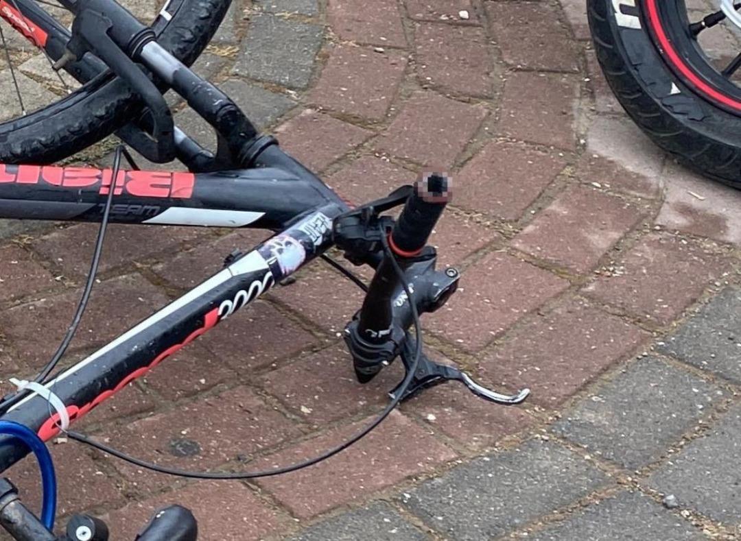 Bisikletten düşen çocuğun bacağına direksiyon saplandı 2