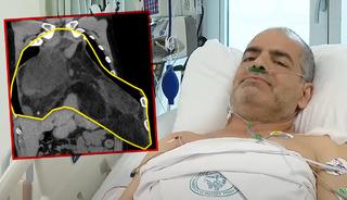 Türkiye’de bilinen ilk vaka! Ne doktorlar inanabildi ne de kendisi: ‘Şok geçirdim’