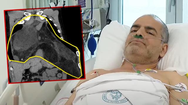 Türkiye’de bilinen ilk vaka! Ne doktorlar inanabildi ne de kendisi: ‘Şok geçirdim’