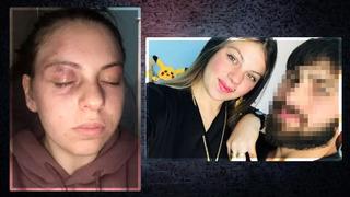 Milli sporcu, eşine kabusu yaşattı! Genç kadın Yaşamak istiyorum diyerek anlattı: Bacaklarının arasında boğmaya çalıştı, az kalsın ölüyordum