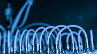 En hızlı DNS ayarları (Türkiye 2025)