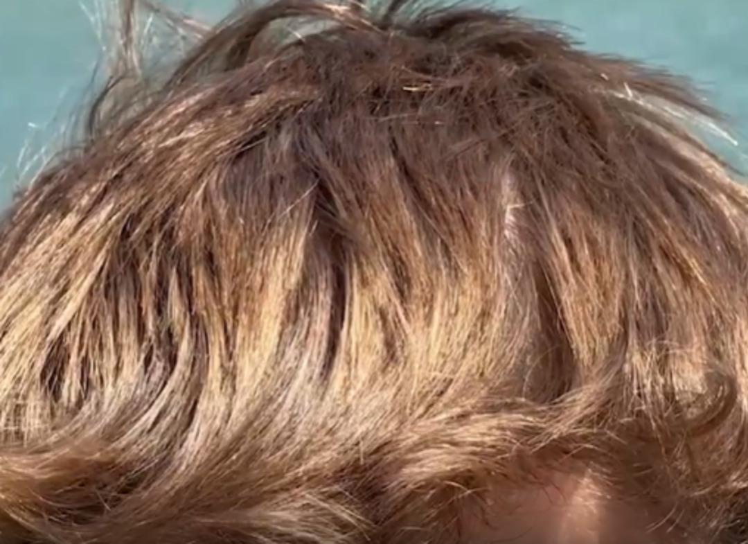 Ünlü göle giren sarı olarak çıkıyor! Uzman nedenini açıkladı! “Kışın Ronaldo ya yazın Osimhen e benziyorum” 1