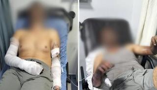 Manisa'da oto tamirhanesinde patlama: 2 kişi ölümden döndü