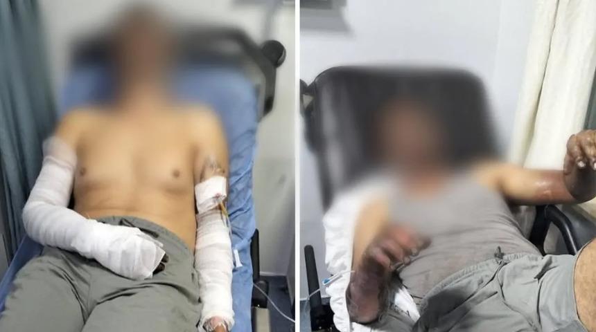 Manisa'da oto tamirhanesinde patlama: 2 kişi ölümden döndü