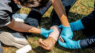 Kırık ve burkulmalarda ilk yardım nasıl yapılır?