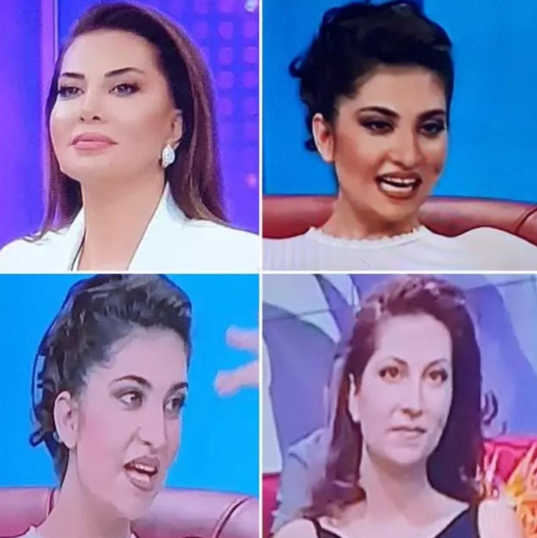 Ebru Yaşar ın hareketsiz gamzesi dile düştü! Estetikle değişimi yeniden gündemde 1