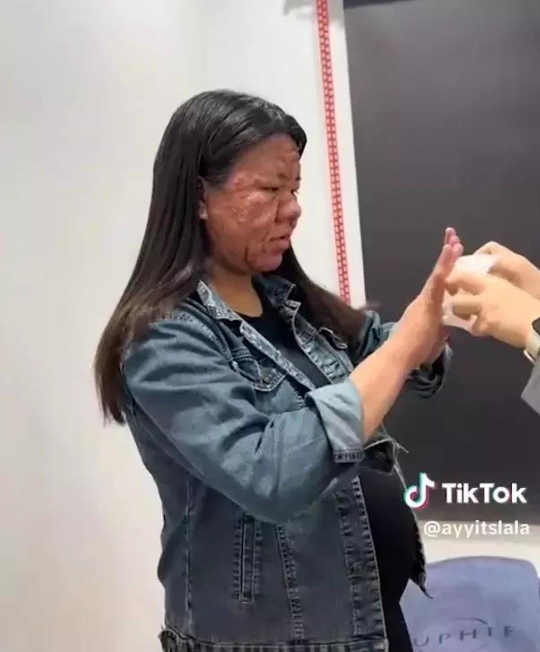 Daha önce böylesi görülmedi! Hamile kaldı, tanınmayacak hale geldi! Nedeni ise... 2