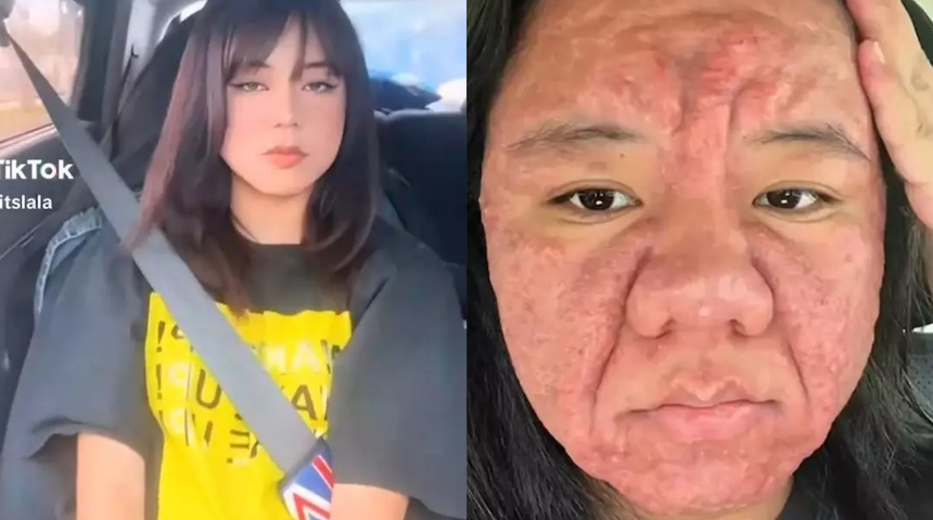 Daha önce böylesi görülmedi! Hamile kaldı, tanınmayacak hale geldi! Nedeni ise...