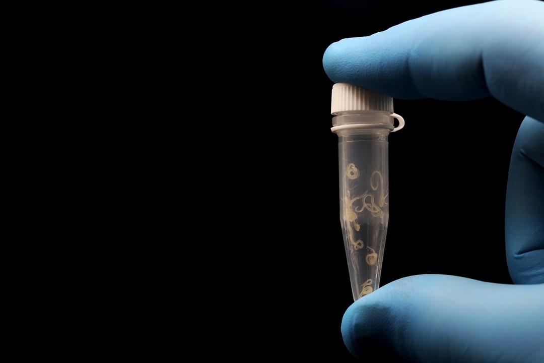 Heidi Klum da uyguladı! Uzmanlar parazit temizliği trendine karşı uyardı: "Ölümcül olabilir" 3