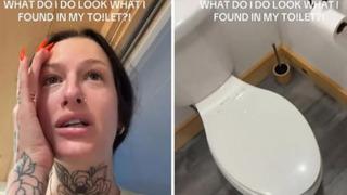 Klozet kapağını kaldırdı hayatının şokunu yaşadı! Takipçileri uyardı hastaneye koştu