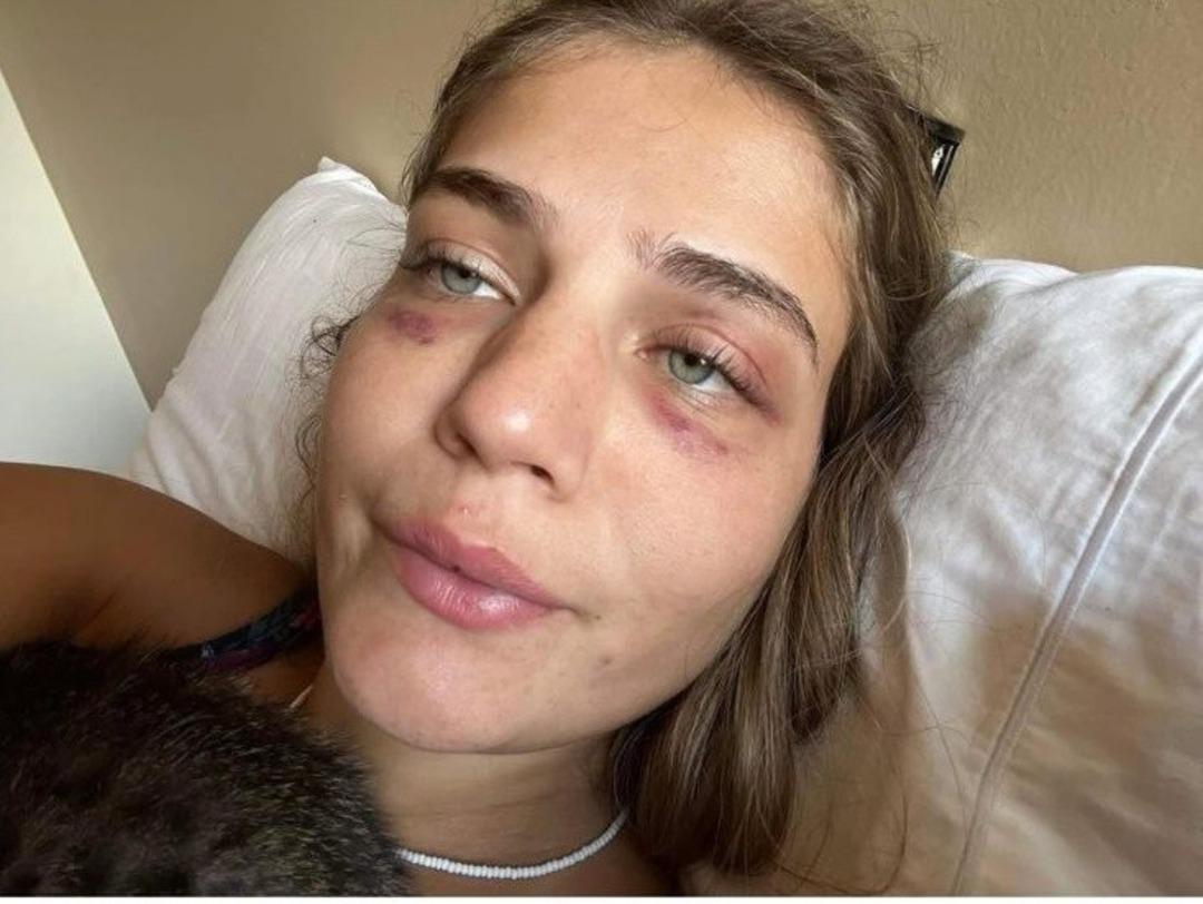 Futbolcu hakkında skandal iddia! Model sevgilisini merdivene bağlayıp işkence etmiş!  2