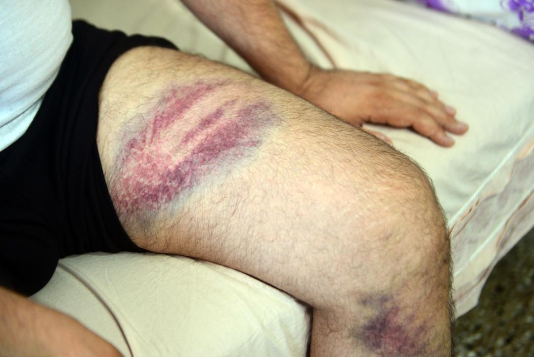 9 kardeş 300 dönümlük mirası paylaşamadı!  Doğu adetinde kadınlara miras yok  diyerek yeğenini beyzbol sopasıyla dövdü 10