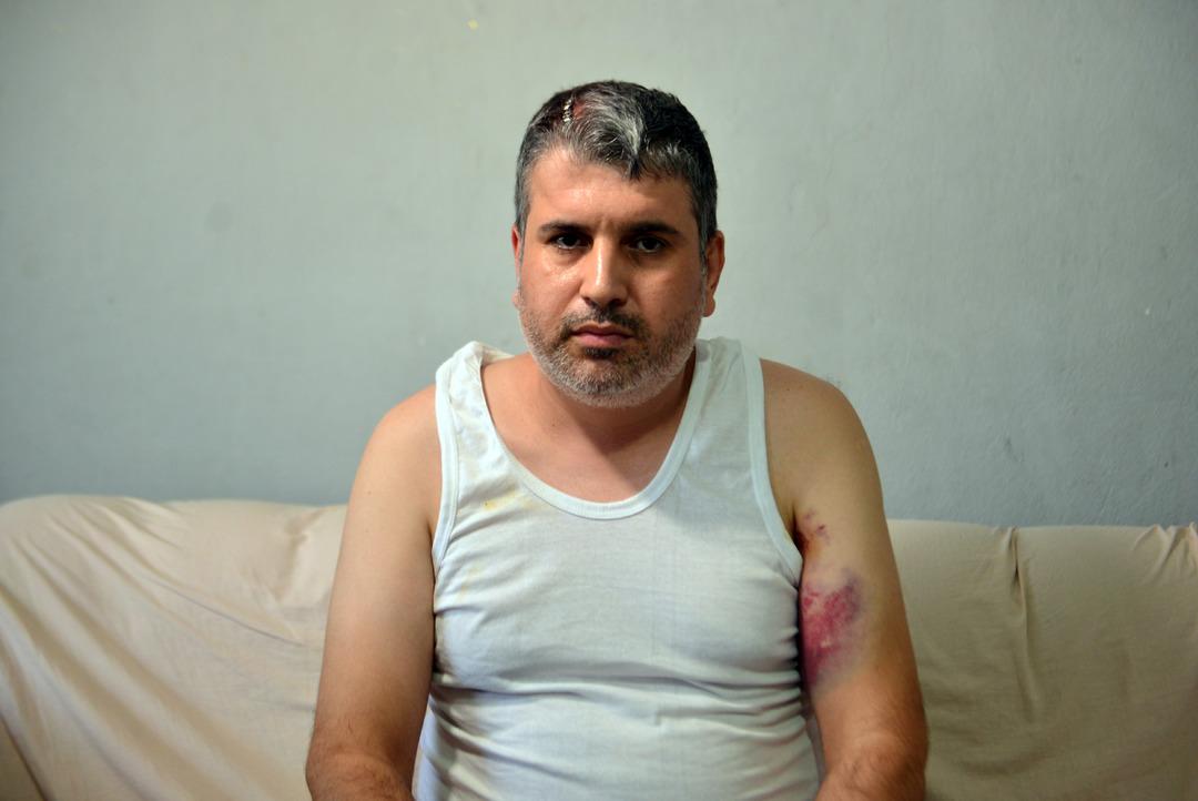 9 kardeş 300 dönümlük mirası paylaşamadı!  Doğu adetinde kadınlara miras yok  diyerek yeğenini beyzbol sopasıyla dövdü 9