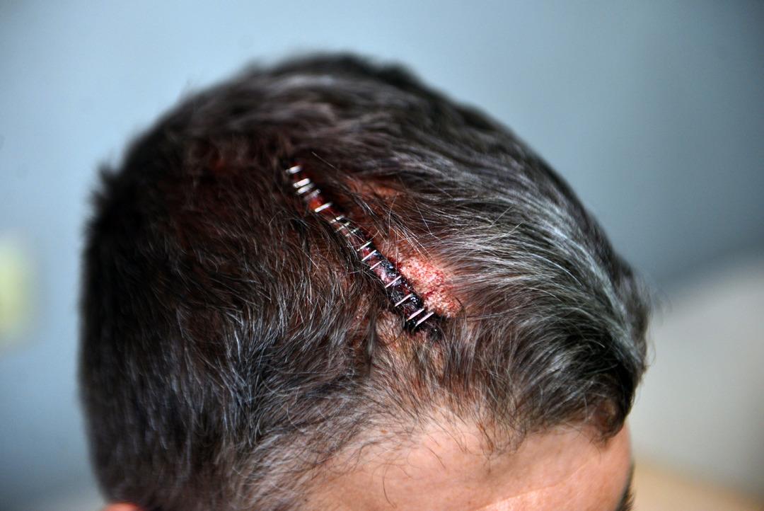 9 kardeş 300 dönümlük mirası paylaşamadı!  Doğu adetinde kadınlara miras yok  diyerek yeğenini beyzbol sopasıyla dövdü 3