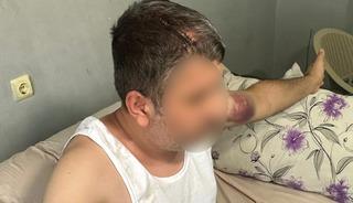 Adana'da dayısı tarafından beyzbol sopasıyla darbedilen kişi yaralandı