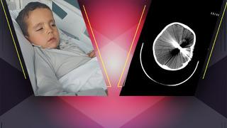 5 yaşındaki çocuğun hayatını kararttı! Osmaniye'deki maganda serbest kaldı: Muhammet Hasan’ın hayatı, hayalleri, çocukluğu ne olacak?