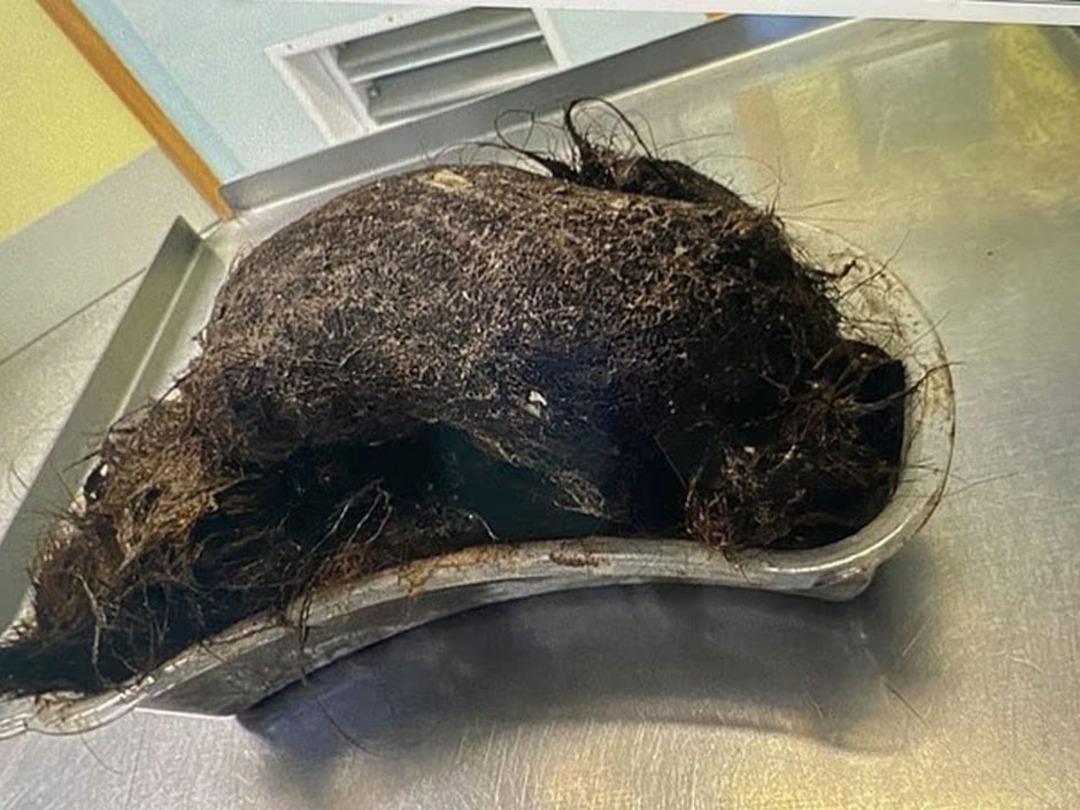 Aylarca karın ağrısı çekti, doktora gidince gerçeği öğrendi! Yıllarca onunla yaşamış... 2