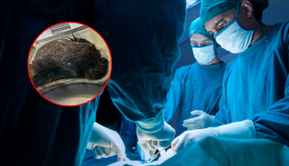 Doktorlar karnını açınca şaştı kaldı! Yıllarca içinde büyümüş...