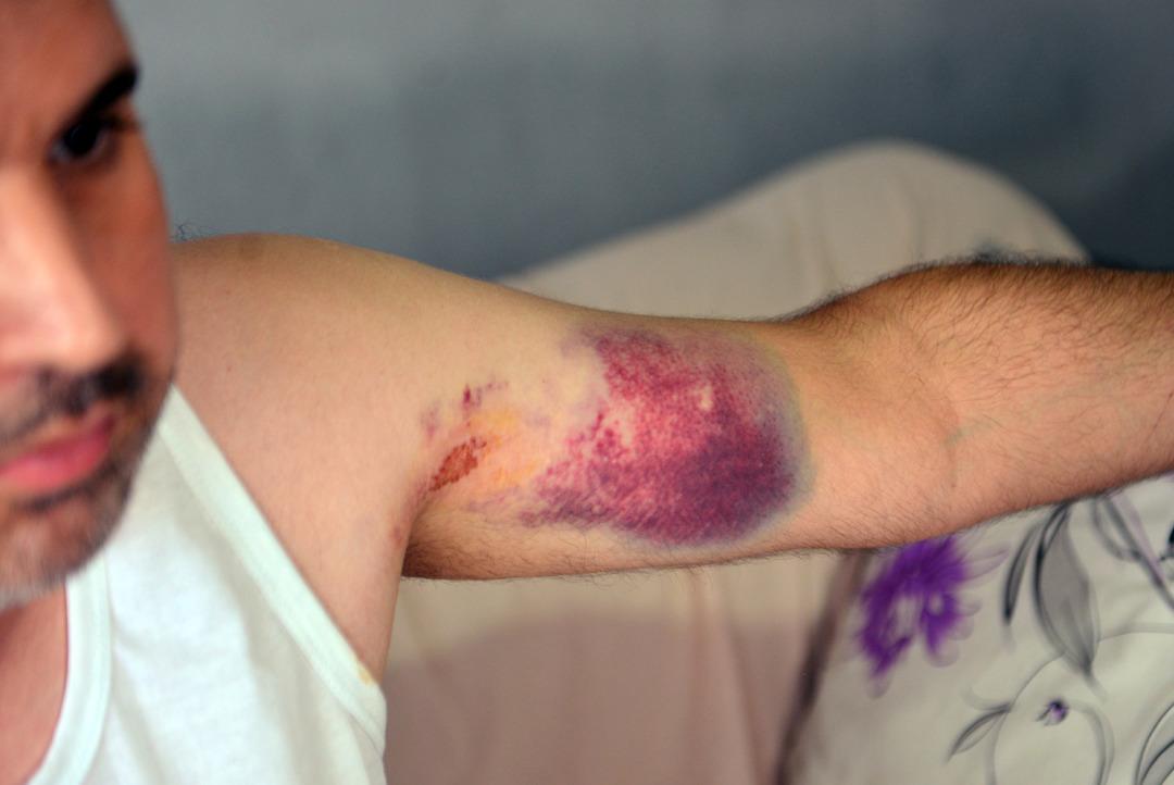 Yeğenini beyzbol sopasıyla darp etti! "Beni tahrik etti, dayanamadım" 4