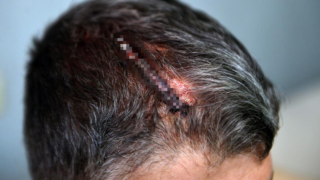 Yeğenini beyzbol sopasıyla darp etti! "Beni tahrik etti, dayanamadım" 3