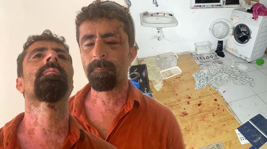 Antalya'da öfkeli damat dehşeti: Karısı terk edince kayınpederini hastanelik etti