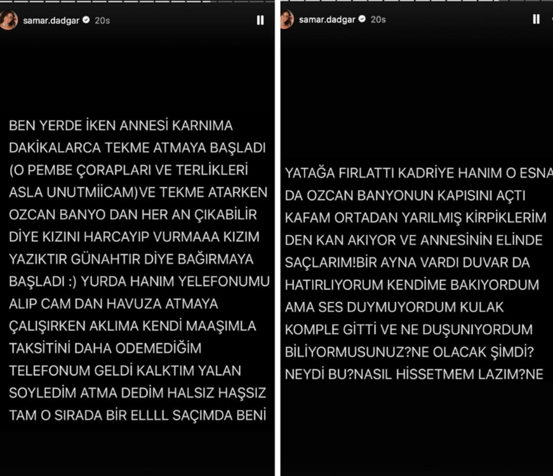 Ortalık durulmuyor! Özcan Deniz in eşi Samar Dadgar kaynanasından yediği dayağı anlattı: 2