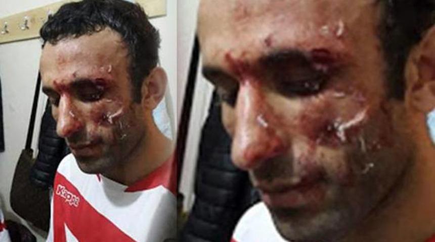 Futbolcuya öldüresiye dayak!